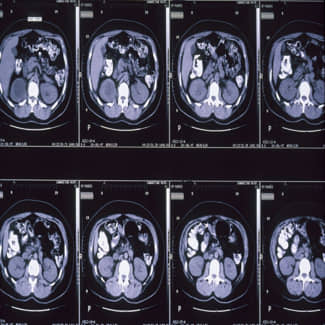Kleine hersenen veel gedetailleerder in beeld gebracht door onderzoekers van Amsterdam UMC